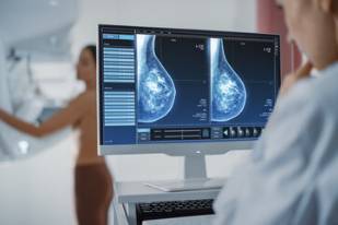 乳腺钼靶X线摄影/ 乳腺超声检查